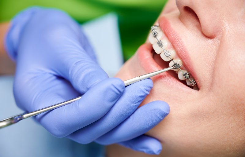 A dentist placing braces on a patient’s teeth 